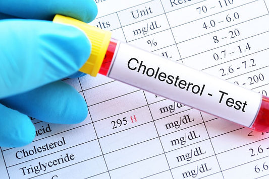 fish oil cholesterol