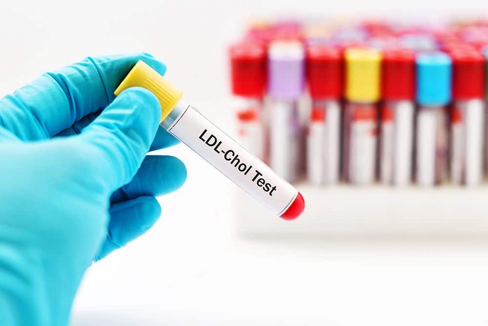 fish oil LDL