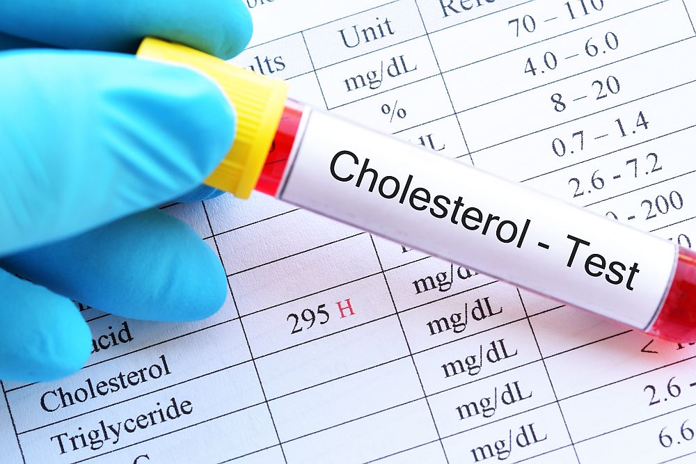 fish oil cholesterol